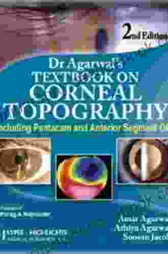 Dr Agarwals Textbook On Corneal Topography (Including Pentacam And Anterior Segment OCT)