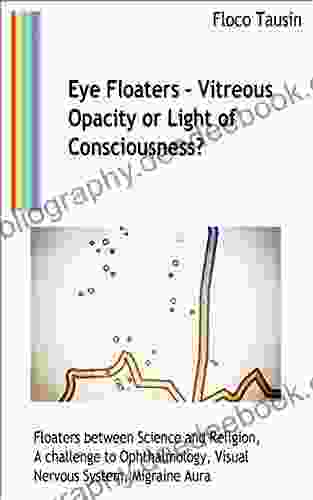 Eye Floaters Vitreous Opacity Or Light Of Consciousness?: Floaters Between Science And Religion A Challenge To Ophthalmology Visual Nervous System Migraine Aura